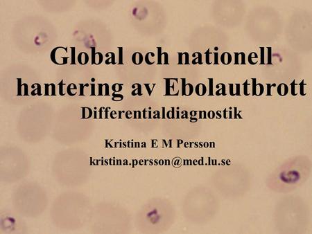 Global och nationell hantering av Ebolautbrott Differentialdiagnostik
