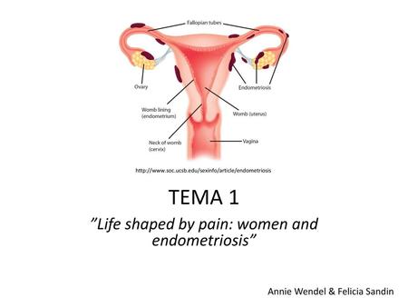 ”Life shaped by pain: women and endometriosis”