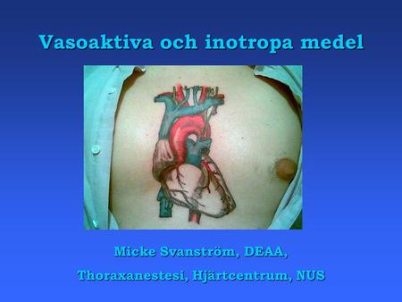 Vasoaktiva och inotropa medel Thoraxanestesi, Hjärtcentrum, NUS