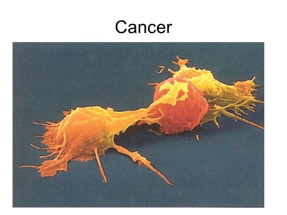 Cancer Den första cancercellen startar alltid i en vanlig frisk cell någonstans i kroppen.
