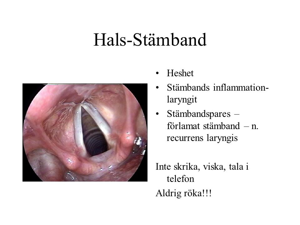 Hals-Stämband Heshet Stämbands inflammation-laryngit