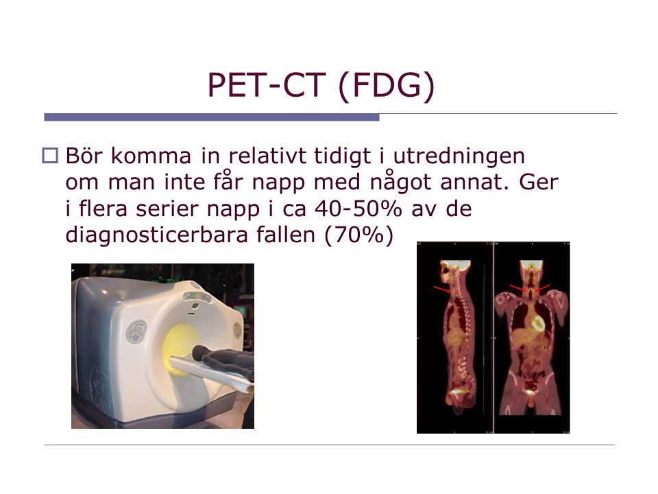 PET-CT (FDG)