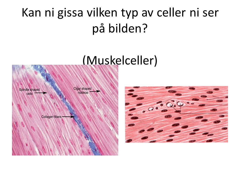 Kan ni gissa vilken typ av celler ni ser på bilden (Muskelceller)
