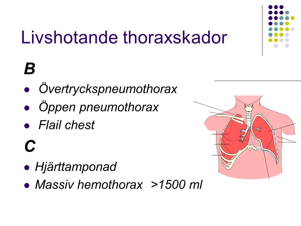 Livshotande thoraxskador