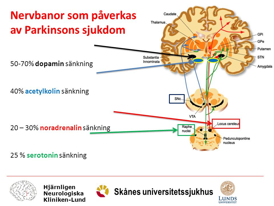 Nervbanor som påverkas av Parkinsons sjukdom