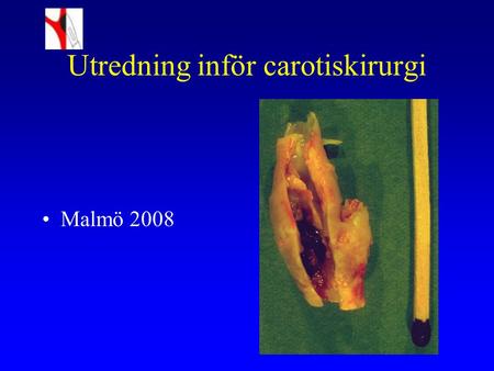 Utredning inför carotiskirurgi