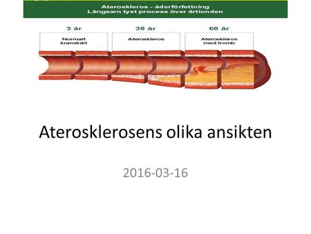 Aterosklerosens olika ansikten 2016-03-16. Välkomna !!