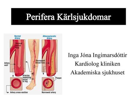 Perifera Kärlsjukdomar