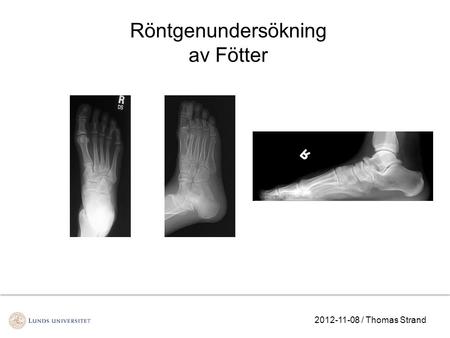 Röntgenundersökning av Fötter