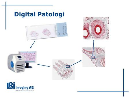 Digital Patologi.