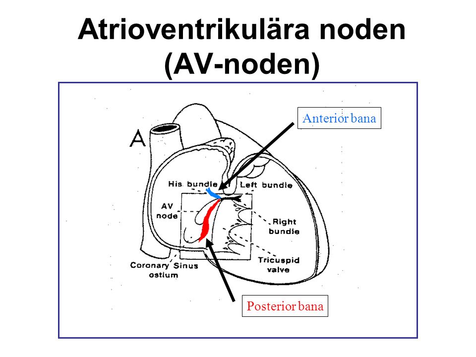 Atrioventrikulära noden (AV-noden)