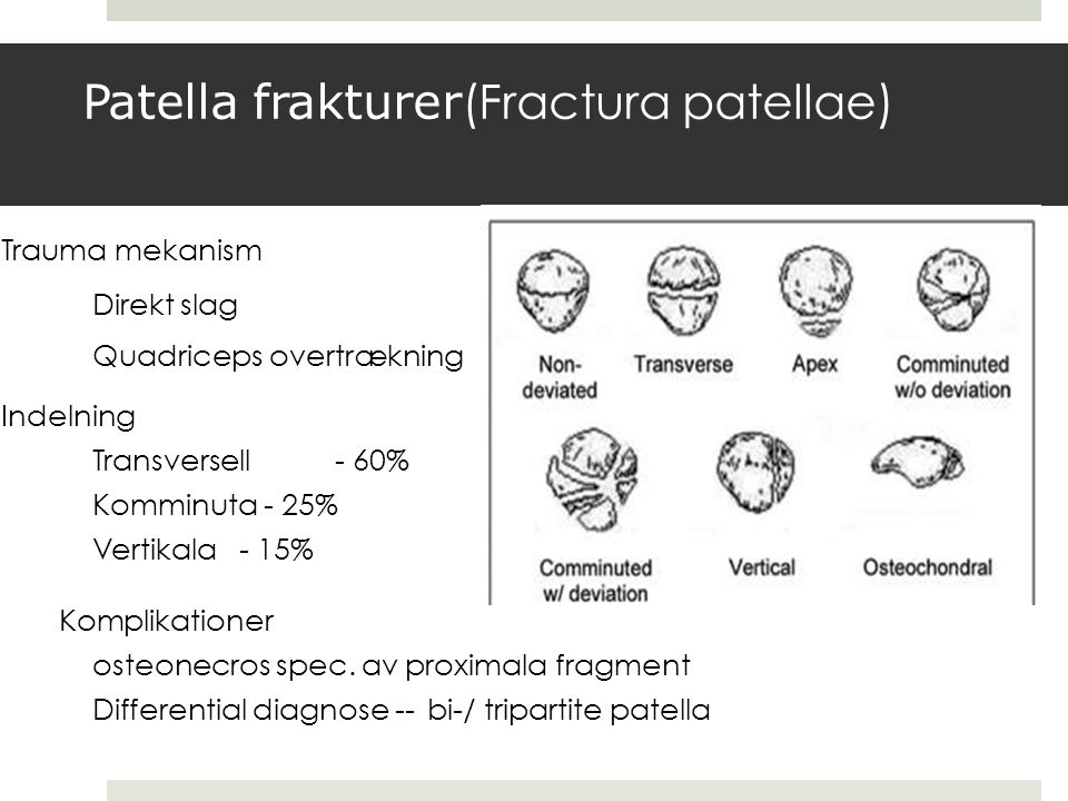 Patella frakturer(Fractura patellae)