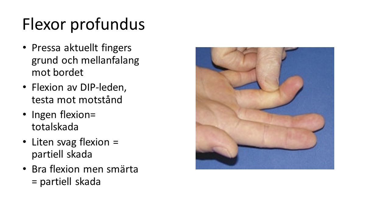 Flexor profundus Pressa aktuellt fingers grund och mellanfalang mot bordet. Flexion av DIP-leden, testa mot motstånd.