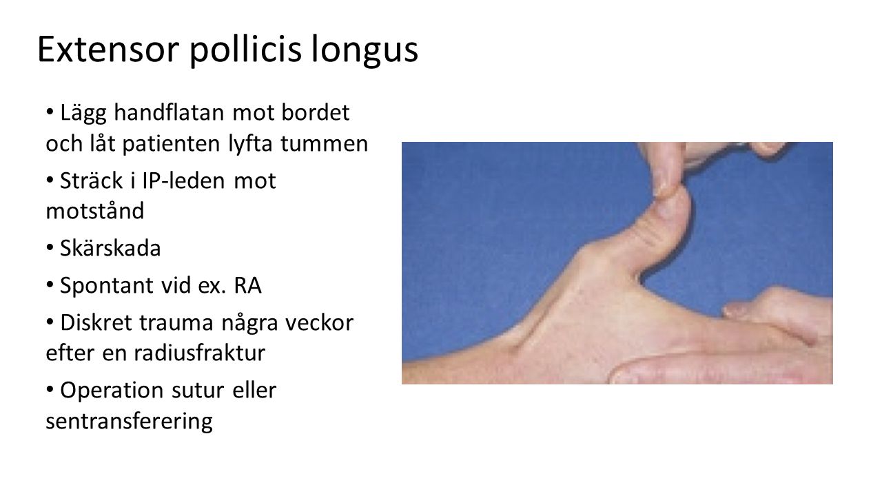 Extensor pollicis longus