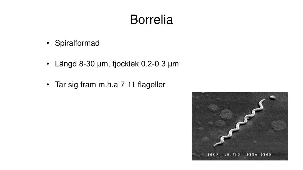 Borrelia Spiralformad Längd 8-30 µm, tjocklek µm