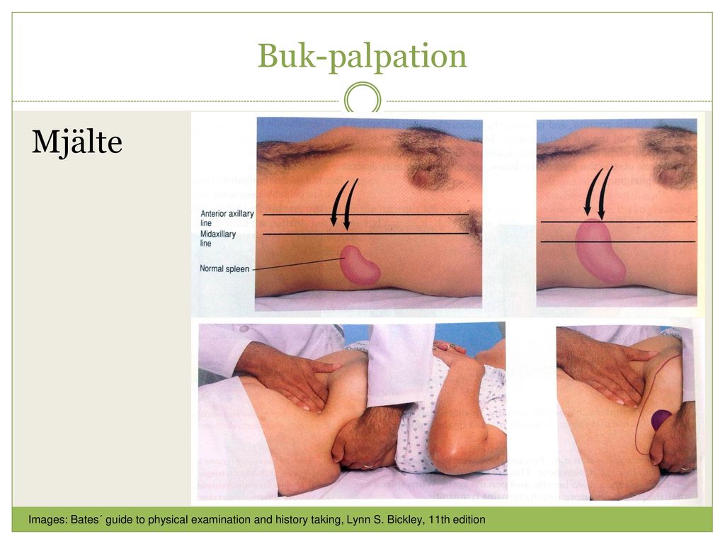 Buk-palpation Mjälte. Images: Bates´ guide to physical examination and history taking, Lynn S.