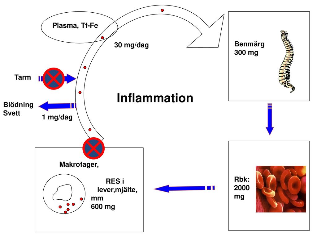 Inflammation Plasma, Tf-Fe Benmärg 30 mg/dag 300 mg Tarm Blödning