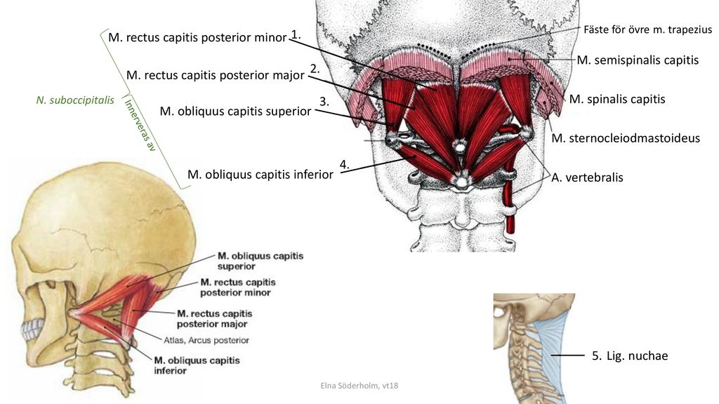 M. rectus capitis posterior minor 1.