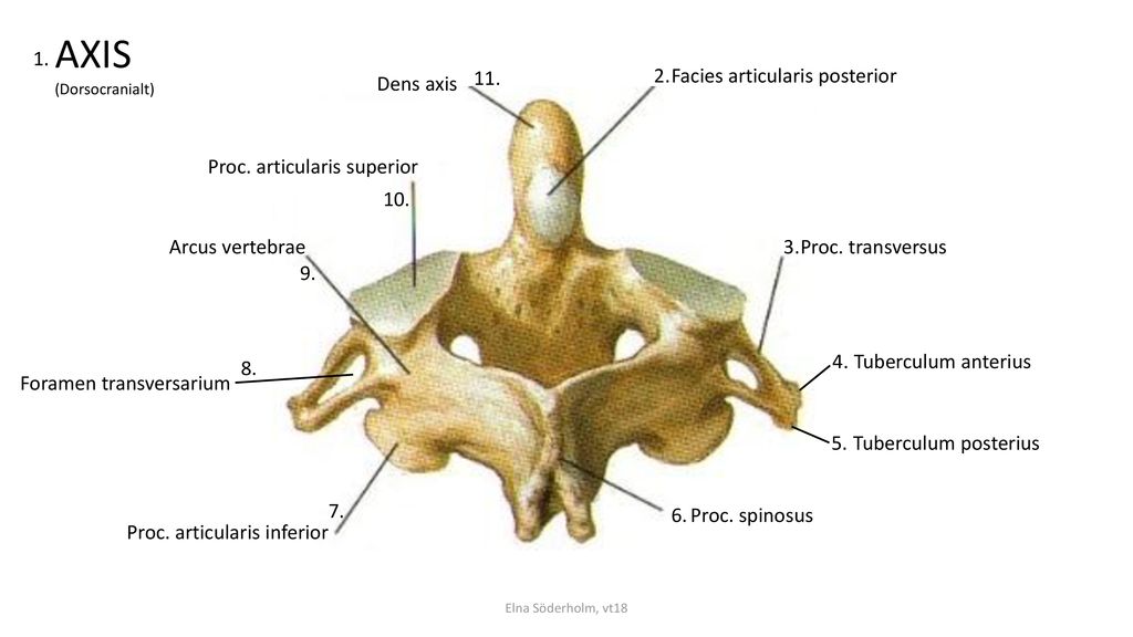 AXIS 1. Dens axis Facies articularis posterior