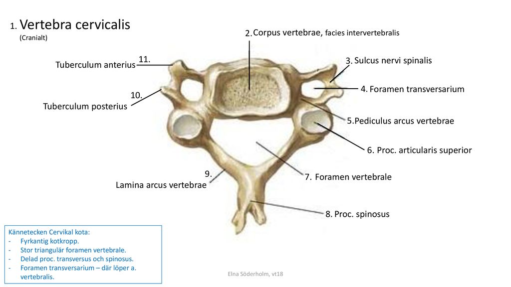 Vertebra cervicalis Corpus vertebrae, facies intervertebralis