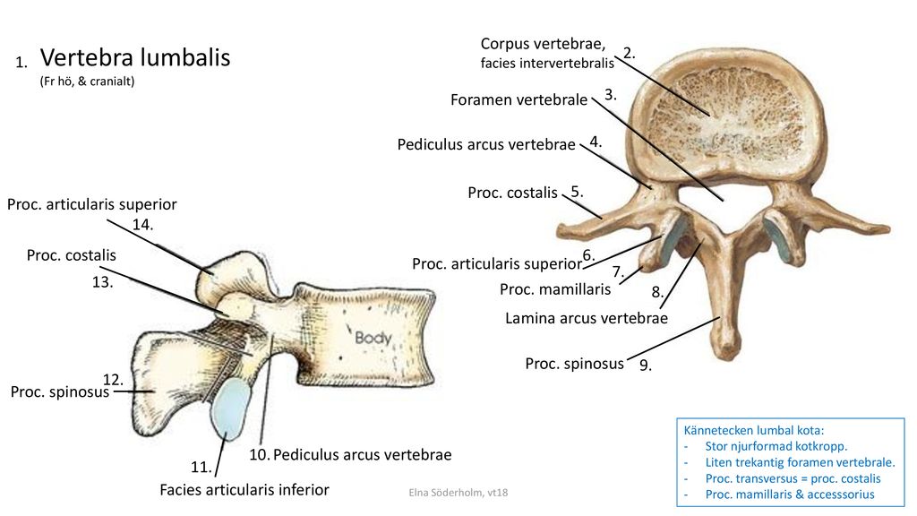 Vertebra lumbalis Corpus vertebrae, Foramen vertebrale