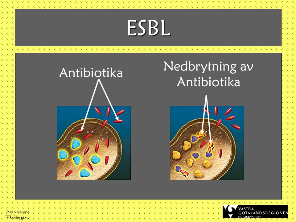 ESBL Antibiotika Nedbrytning av Antibiotika Aino Kempe Vårdhygien