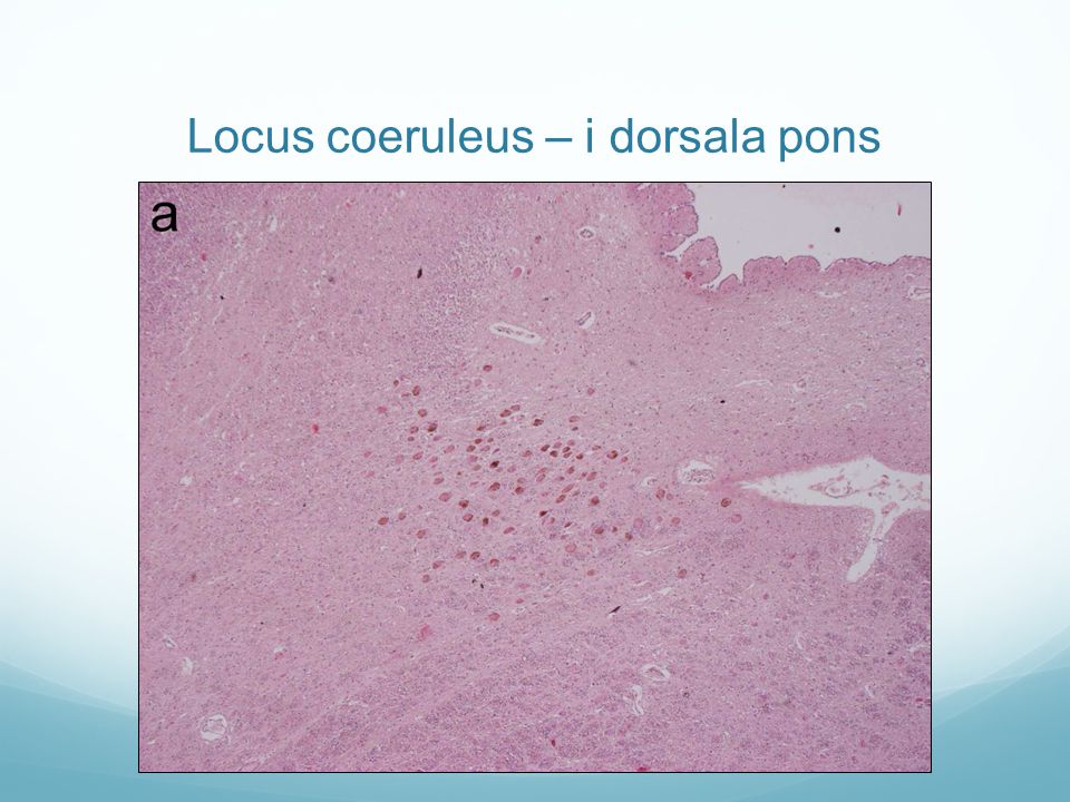 Locus coeruleus – i dorsala pons