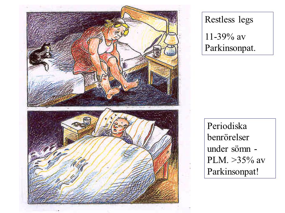 Restless legs 11-39% av Parkinsonpat. Periodiska benrörelser under sömn - PLM.