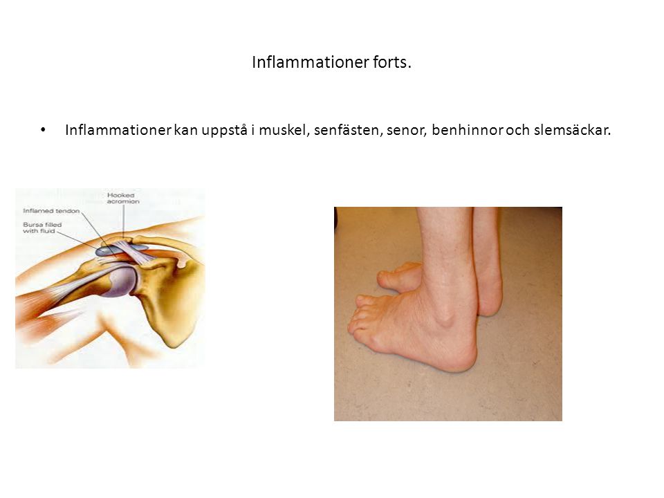 Inflammationer forts.