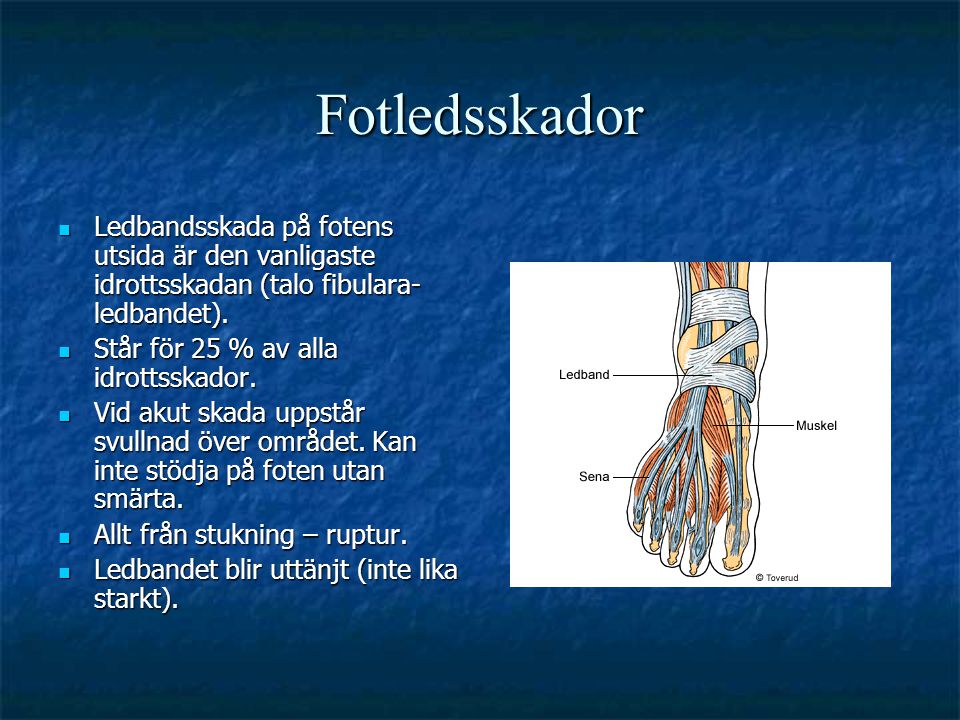 Fotledsskador Ledbandsskada på fotens utsida är den vanligaste idrottsskadan (talo fibulara- ledbandet).