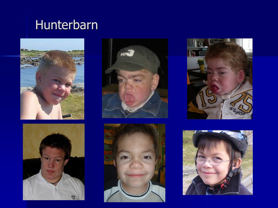 Hunterbarn Stort spektrum, En pojke är från Norge och trackeostomerad pga för trånga luftvägar.