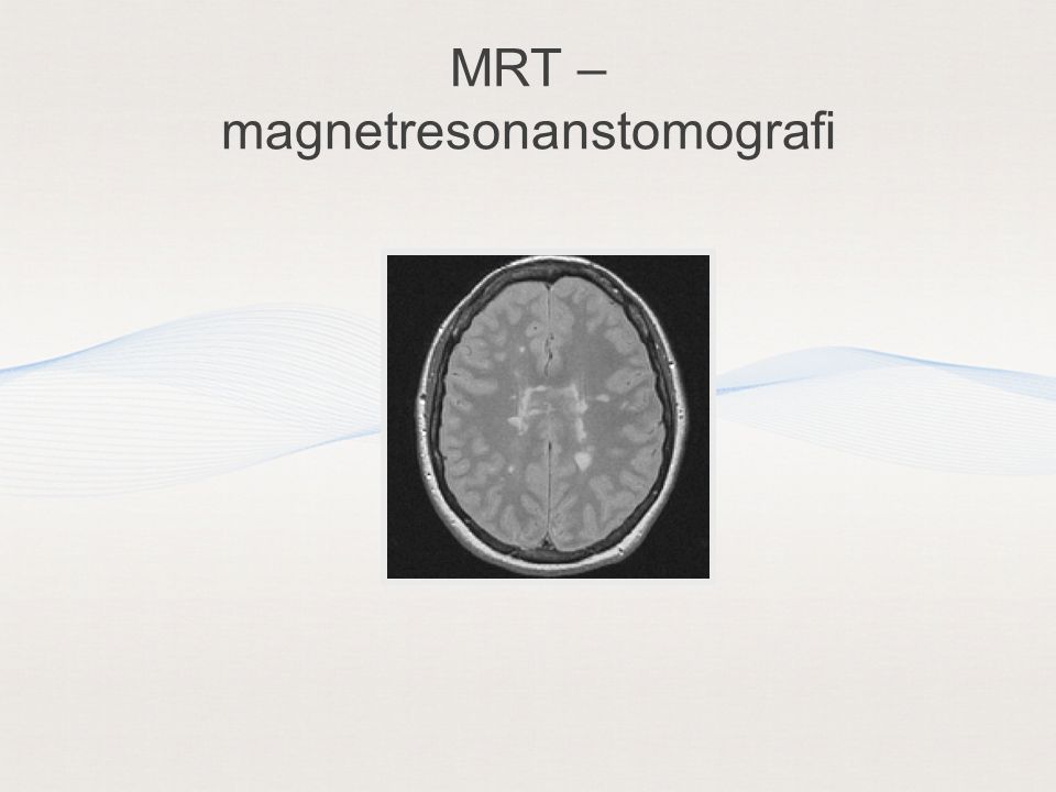 MRT – magnetresonanstomografi