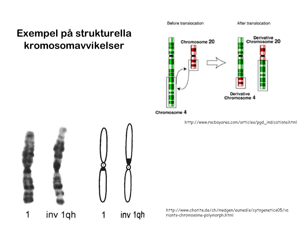 Exempel på strukturella kromosomavvikelser