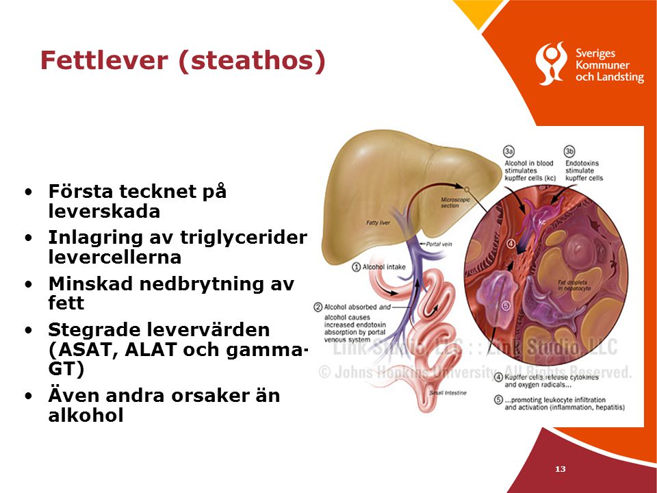 Fettlever (steathos) Första tecknet på leverskada