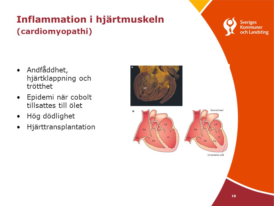 Inflammation i hjärtmuskeln (cardiomyopathi)