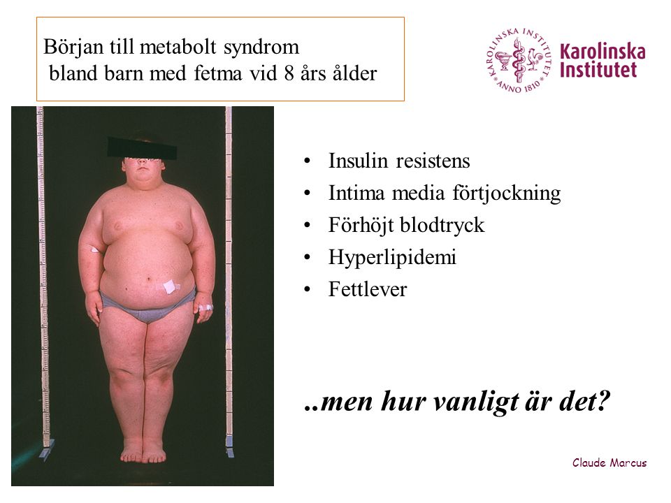 Början till metabolt syndrom bland barn med fetma vid 8 års ålder