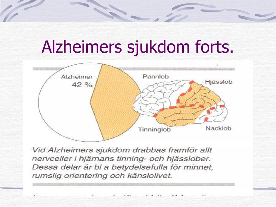 Alzheimers sjukdom forts.