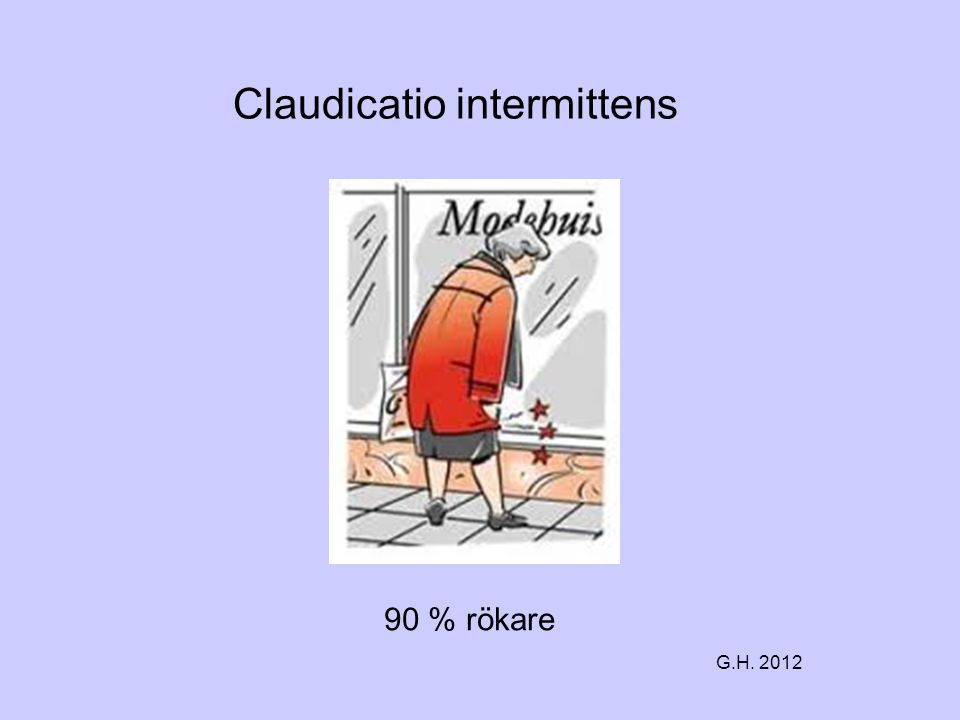 Claudicatio intermittens