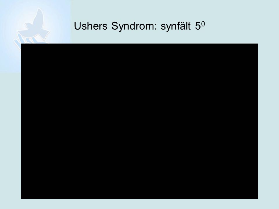 Ushers Syndrom: synfält 50