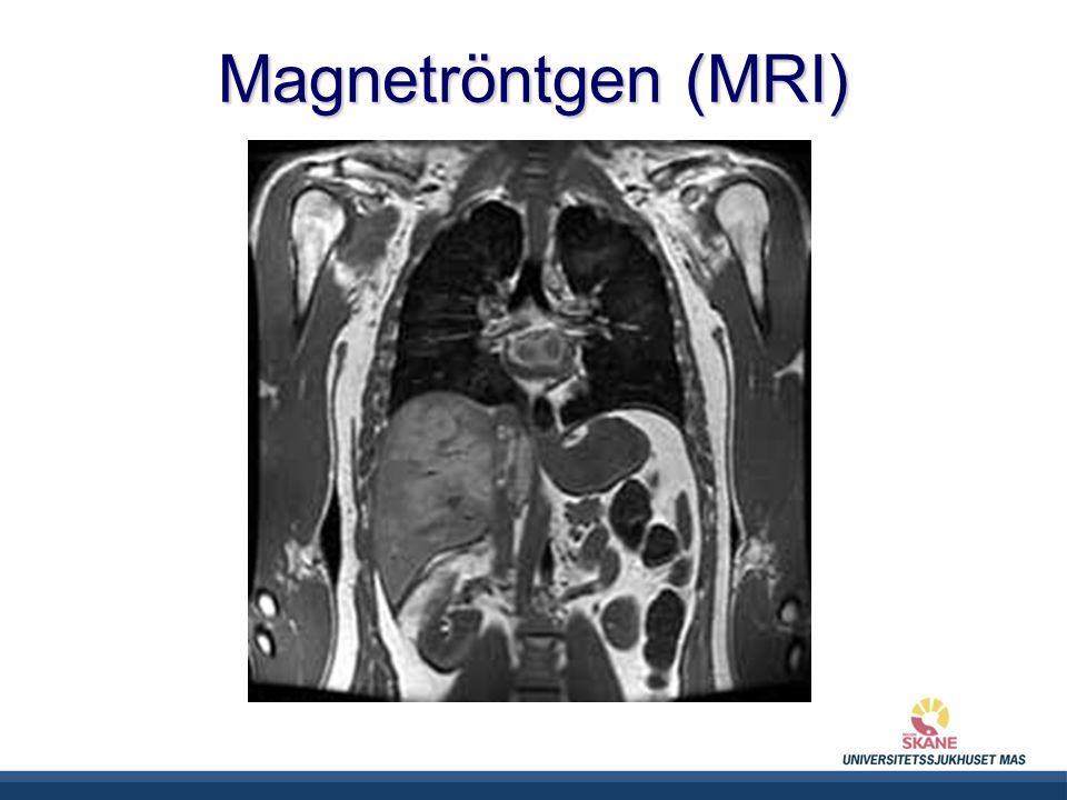 Magnetröntgen (MRI)