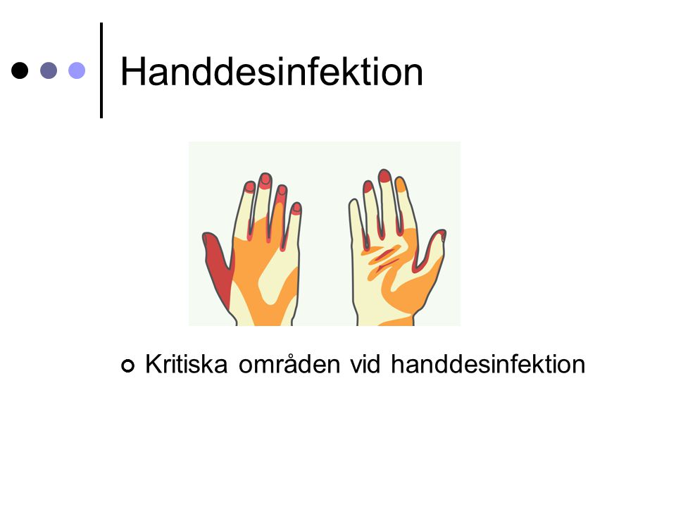 Handdesinfektion Kritiska områden vid handdesinfektion
