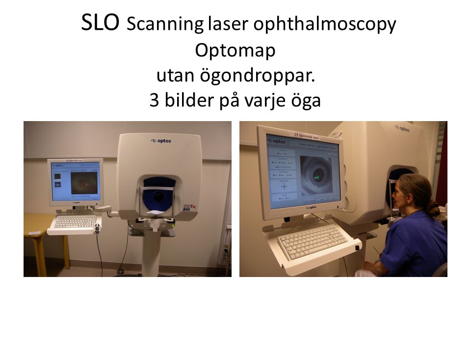 SLO Scanning laser ophthalmoscopy Optomap utan ögondroppar