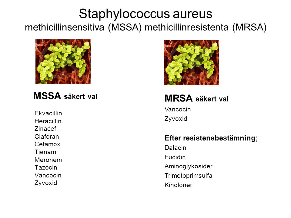 Staphylococcus aureus methicillinsensitiva (MSSA) methicillinresistenta (MRSA)
