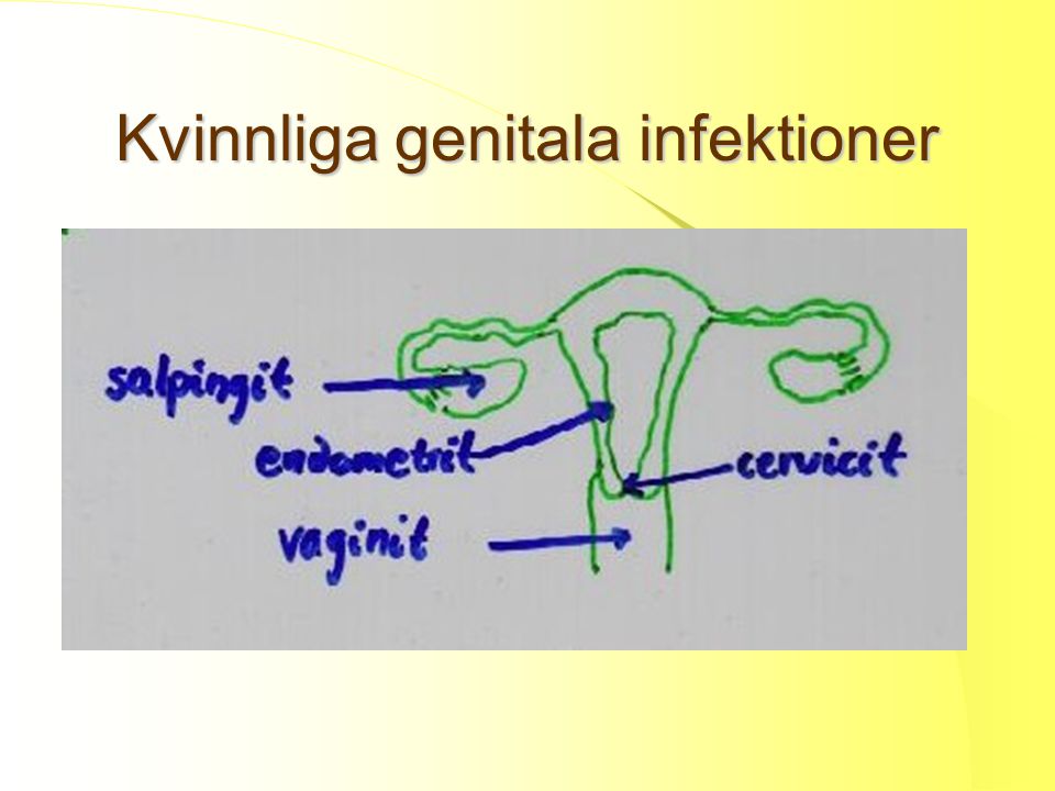 Kvinnliga genitala infektioner