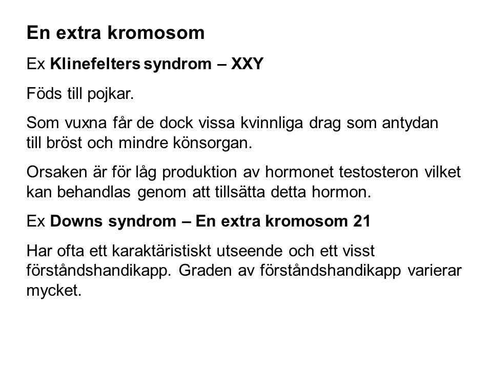 En extra kromosom Ex Klinefelters syndrom – XXY Föds till pojkar.