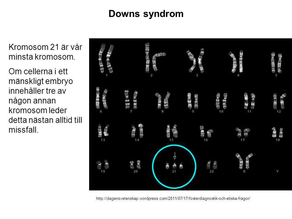 Downs syndrom Kromosom 21 är vår minsta kromosom.