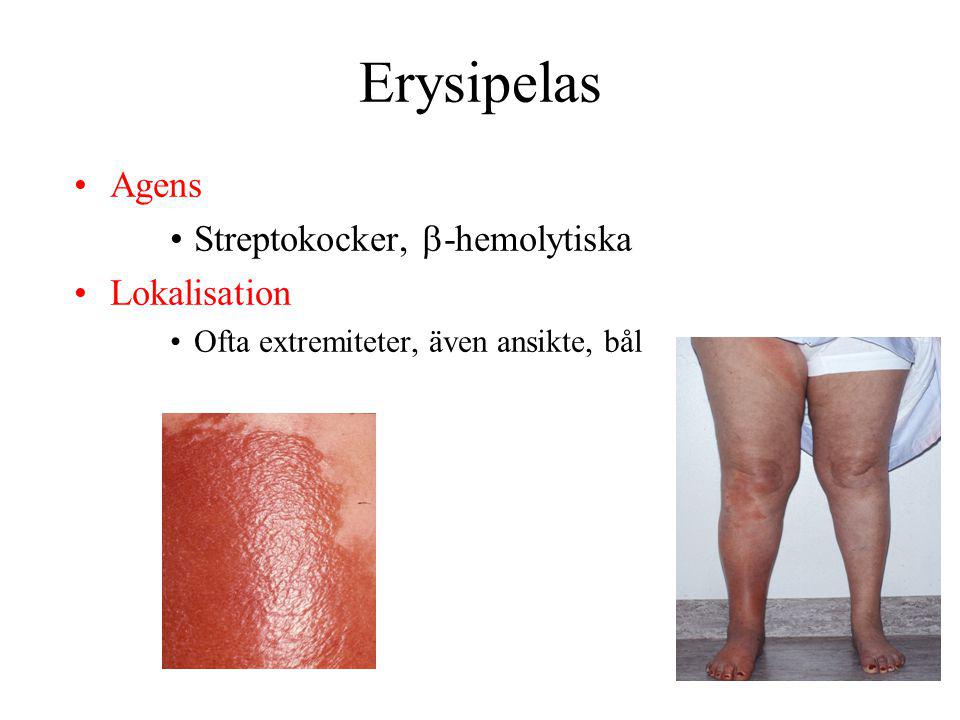 Erysipelas Agens Streptokocker, -hemolytiska Lokalisation