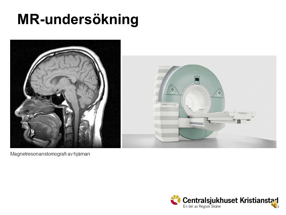 MR-undersökning Magnetresonanstomografi av hjärnan