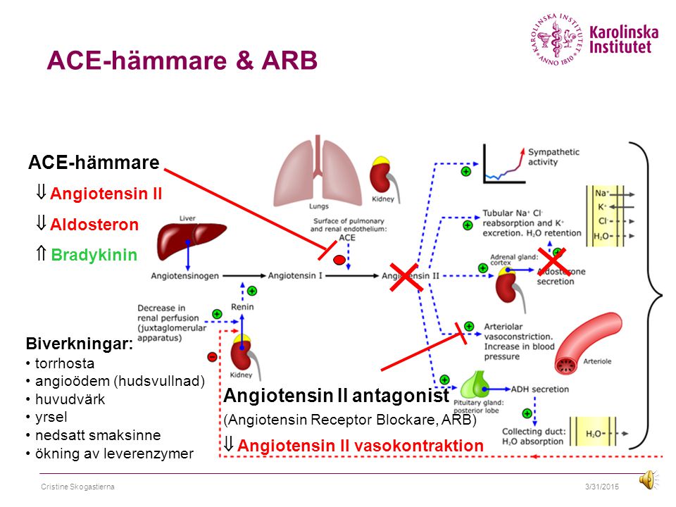 ACE-hämmare & ARB ACE-hämmare Angiotensin II antagonist